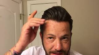 When is your Hairline Ready to be Redone? Also some ranting. Hair Systme and Hair Replacement