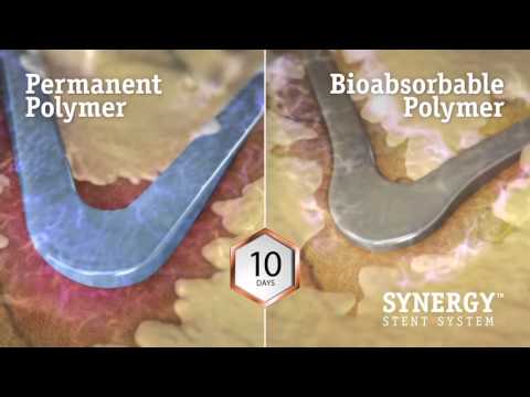 Designed to Heal   Why the SYNERGY Stent is Different