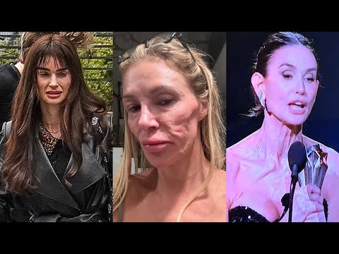 BANNED Footage Shows How Ozempic Is DESTROYING Celebs’ Bodies