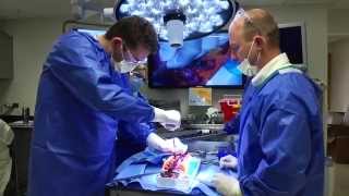 Simulation Training for Future Pediatric Orthopedic Surgeons