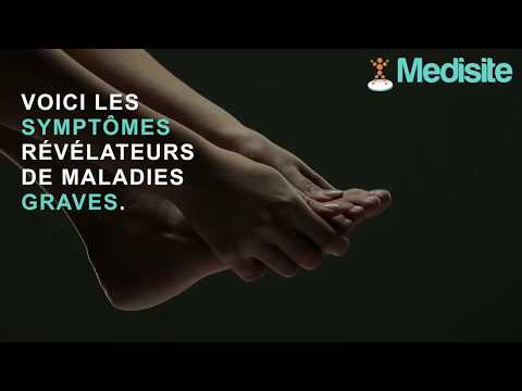 Pieds : ces signes devraient vous inquiéter