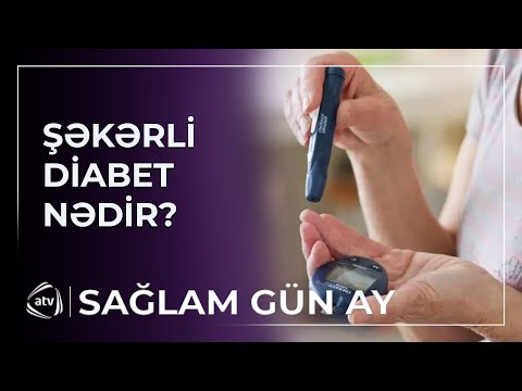 Şəkər xəstəliyinin əlamətləri nələrdir?