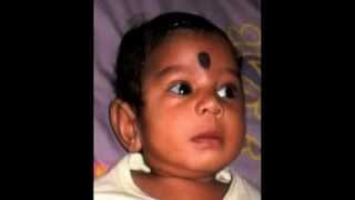 preview picture of video 'Hansika the little angel. Leigh`s syndrome.'