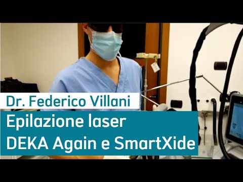 Laser DEKA AGAIN SMARTXIDE - epilazione laser corpo e viso
