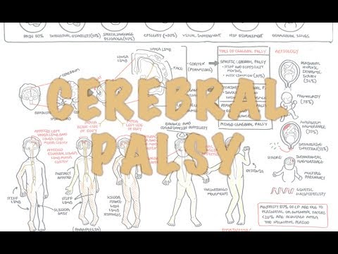 Cerebral Palsy - 