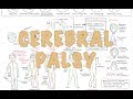 Cerebral Palsy - (DETAILED) Overview