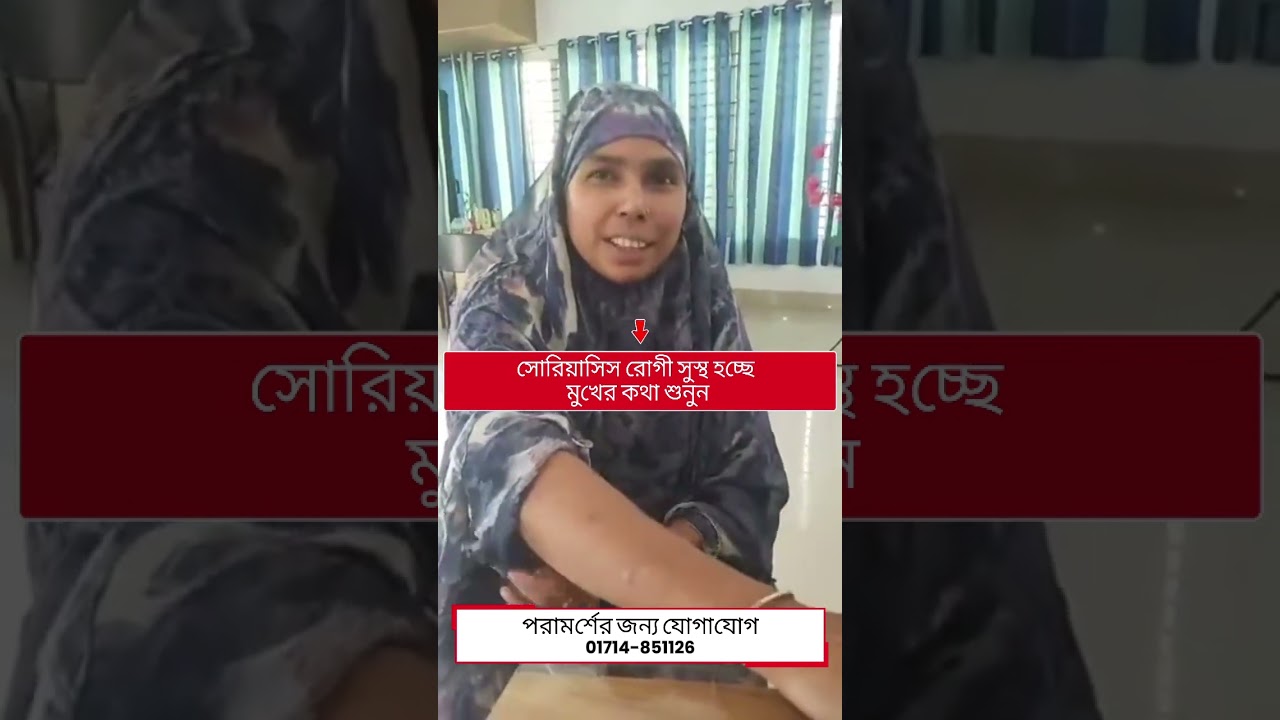 সোরিয়াসিস রোগী সুস্থ হয়েছে তার মুখের কথা শুনুন
