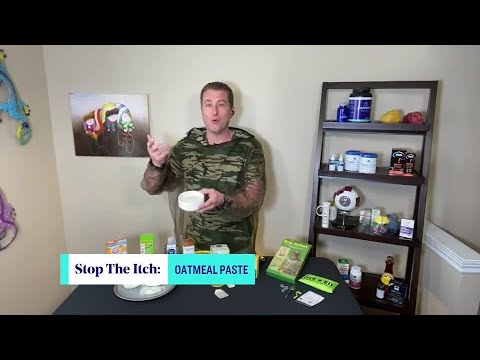 7 home remedies for your peskiest bug bites and stings