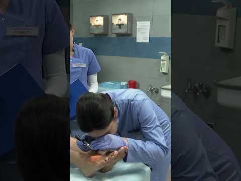 LARWA WĘDRUJĄCA PODSKÓRNA #szpital #shorts