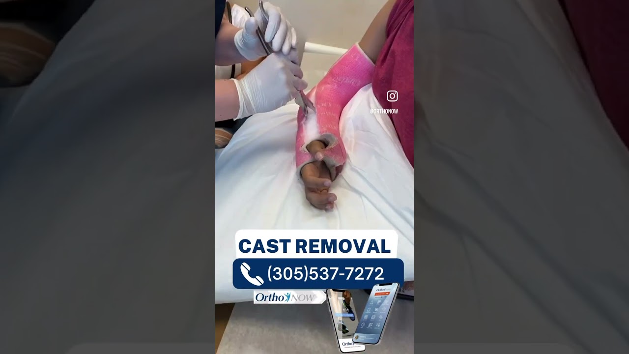 What To Expect During A Cast Removal: Does It Hurt To Have Your Cast Removed?