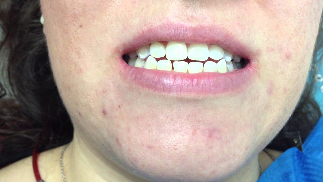 Concepción Carrillo Ramos-9