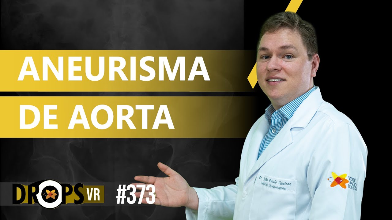 ANEURISMA DE AORTA