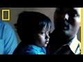 Risky Parasitic Twin Surgery National Geographic