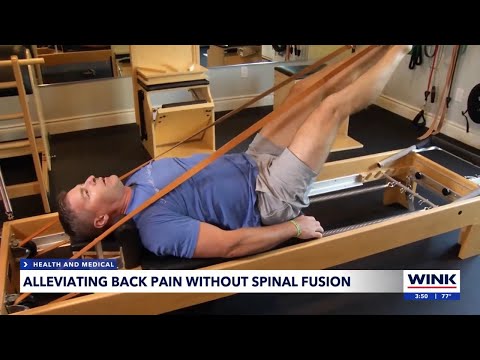 Alleviating back pain without spinal fusion
