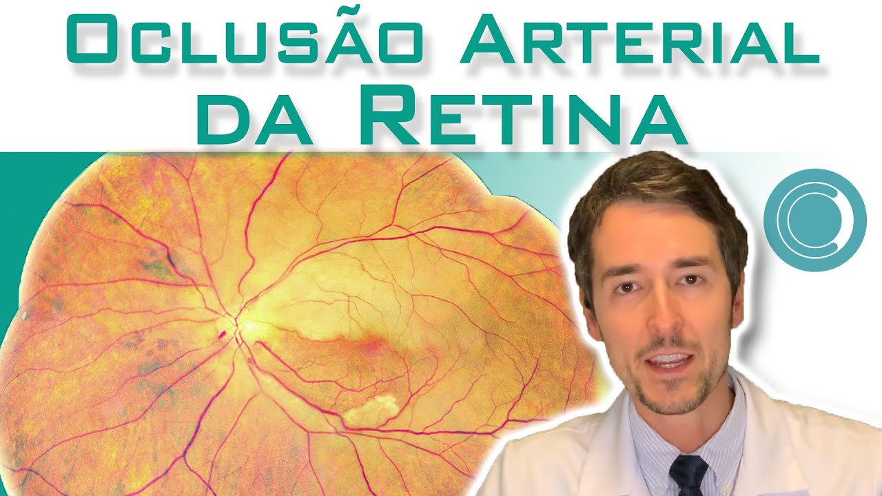 Oclusão arterial da retina