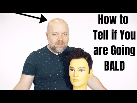 How to Tell if You Are Going BALD - TheSalonGuy