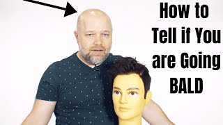 How to Tell if You Are Going BALD - TheSalonGuy