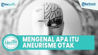 Apa Itu Aneurisma Otak? Pendarahan pada Otak yang Bisa Picu Kematian, Kenali Gejalanya Sejak Dini