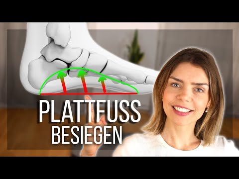 How to train away flat feet (exercises to straighten them up)