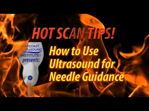 Hot Tip-How to Use Ultrasound for Needle Guidance