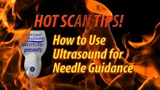 Hot Tip-How to Use Ultrasound for Needle Guidance