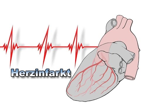 Herzinfarkt | Krankheiten des Herzens | Pflege Kanal