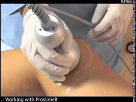 download lagu mp3 mp4 Proslimelt Machine, download lagu Proslimelt Machine gratis, unduh video klip Proslimelt Machine