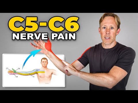 C5-C6 Disc Injury Exercises