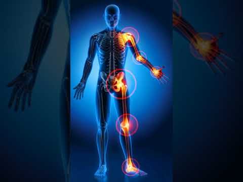 विटामिन-D की कमी से क्या होता है | Symptoms of Vitamin-D Deficiency | Part 1 | #vitamin #vitamind