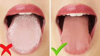 HOW TO: Get Rid of White Tongue &amp; Bad Breath INSTANTLY!