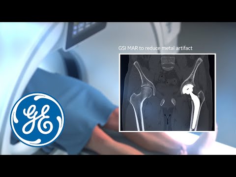 Ge revolution frontier ct scanner