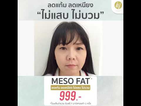 เมโสแฟตเหนียง