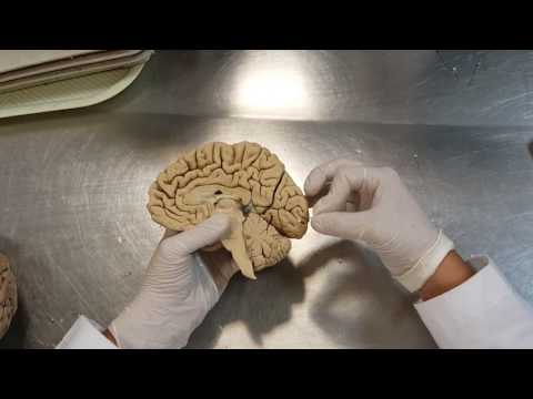 Neuroanatomía: corteza cerebral