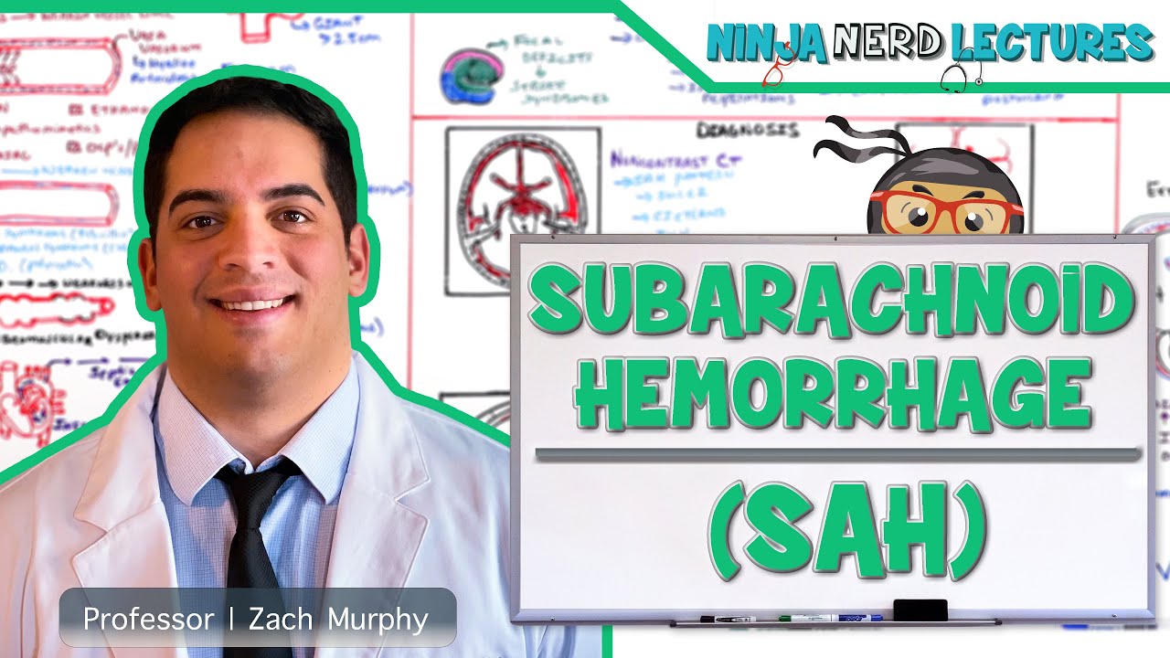 Subarachnoid Hemorrhage | Etiology, Pathophysiology, Clinical Features, Treatment, Complications