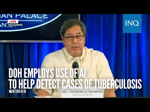 DOH employs use of AI to help detect cases of tuberculosis