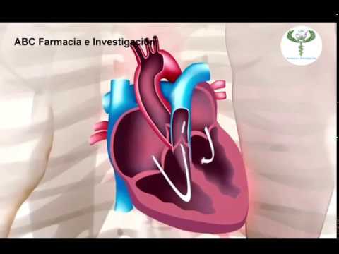Hypertension Schritt 2 3 3 Grad Risiko einer Behinderung Senkung des Blutdrucks, der Lufttemperatur