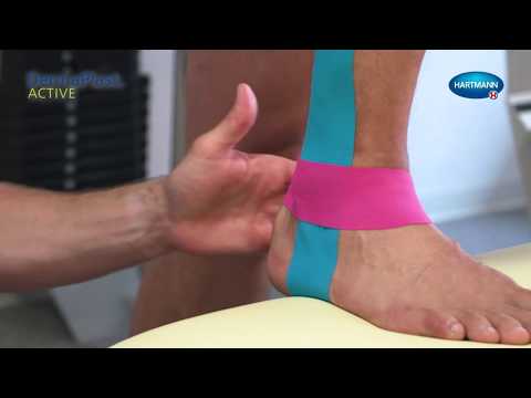 Cât timp să tratezi artrita genunchiului