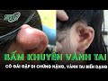 Bấm Khuyên Ở Vành Tai Cô Gái 18 Tuổi Gặp Di Chứng Nặng SKĐS