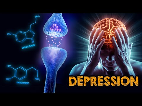 Wie verändern Depressionen unser Gehirn? Einblick in neurologische Ursachen und Auswirkungen