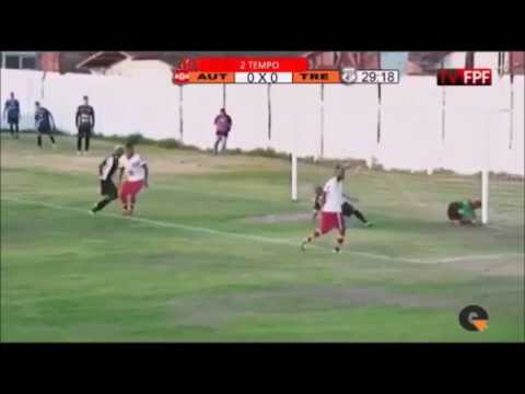 Campeonato Paraibano 2018 - Treze 1x0 Auto Esporte - Reinaldo Alagoano  - NARRAÇÃO ROSTAND LUCENA