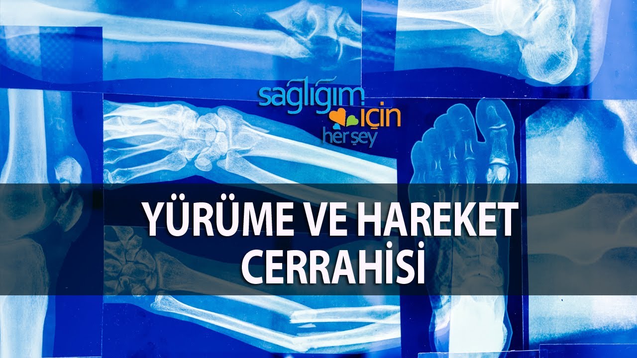 Yürüme ve Hareket Cerrahisi