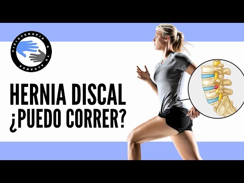 ¿Puedo correr con una hernia discal lumbar?