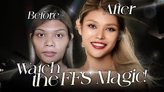 How Facial Feminisation Surgery changed my WHOLE life💖| @Johnreyslife's glow-up at Braun! (Part 1)