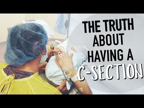 THE TRUTH ABOUT HAVING A C-SECTION! || BETHANY FONTAINE Video