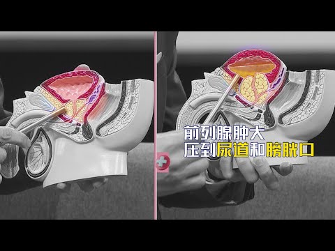 Let's Talk About Health S2 医聊大小事 S2 EP6 | Wearing jeans often can lead to UTI in women?