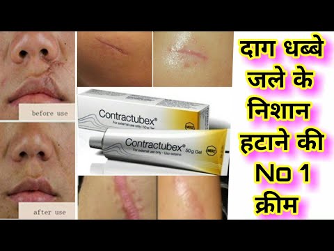 दाग धब्बे जले के निशान हटाने की No 1 क्रीम | contractubex gel | Brijwasi Girl