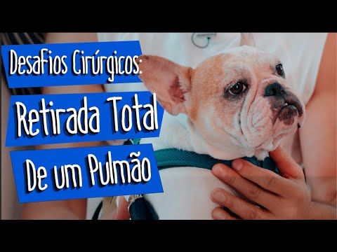 Remoção total do pulmão esquerdo