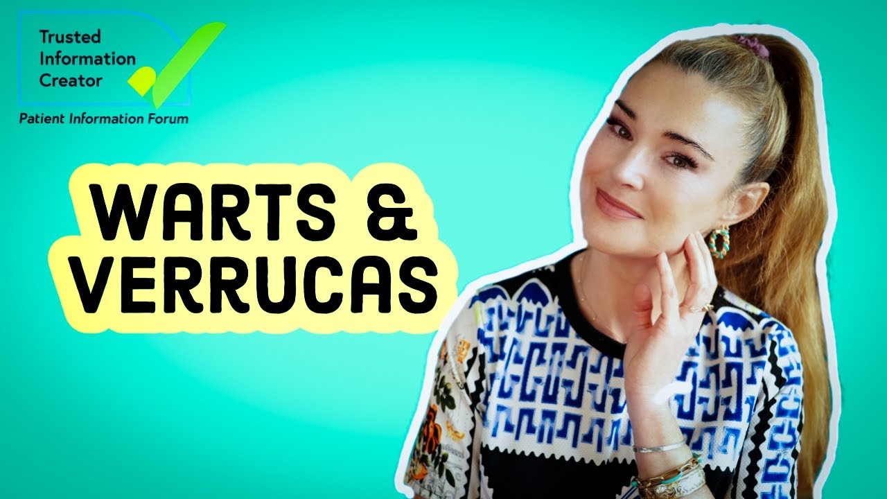 Top Hacks for Wart and Verruca Removal – Doctor’s Tips
