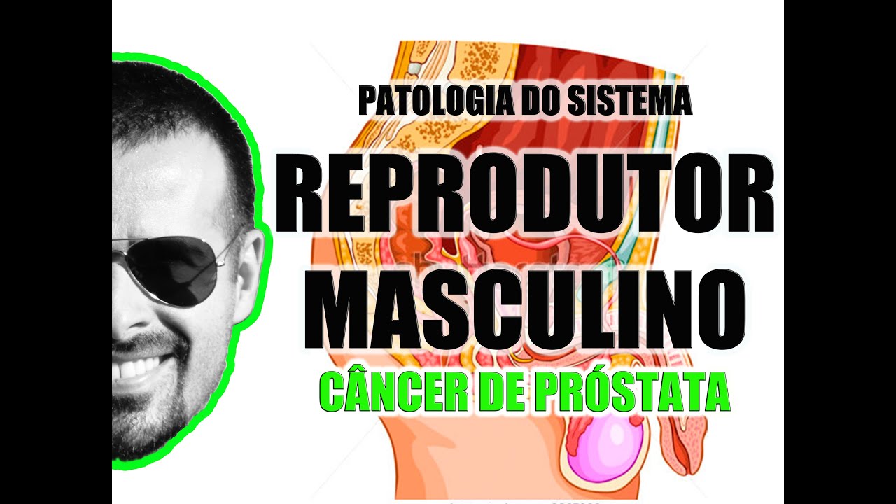 Câncer de próstata e o exame de toque retal - Sistema Reprodutor Masculino - VideoAula 078