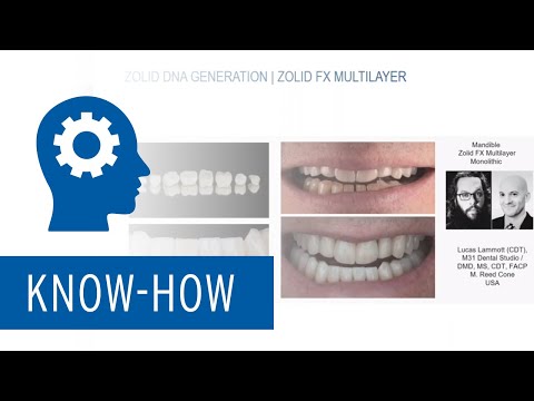 Zolid FX Multilayer vs. Zolid HT+ zirconia - Unterstand the key differences